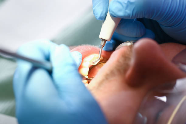 Best Cracked Tooth Emergency Dentist  in Deridder, LA